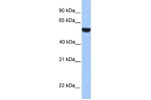 WB Suggested Anti-PHF17 Antibody Titration:  0.