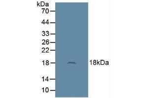 Detection of ADM in Rat Brain Tissue using Polyclonal Antibody to Adrenomedullin (ADM) (Adrenomedullin Antikörper  (AA 22-147))