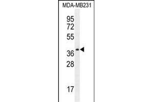 PRSS3 Antibody (N-term) (ABIN654446 and ABIN2844180) western blot analysis in MDA-M cell line lysates (35 μg/lane). (PRSS3 Antikörper  (N-Term))
