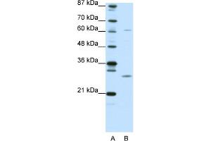 WB Suggested Anti-CRSP9 Antibody Titration:  0. (MED7 Antikörper  (N-Term))