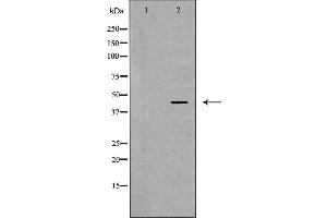 Western blot analysis of MCF7 cell lysate, using LHX8 Antibody. (LHX8 Antikörper  (Internal Region))