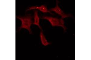 ABIN6267325 staining 293 by IF/ICC. (Tyrosine Hydroxylase Antikörper  (pSer31))