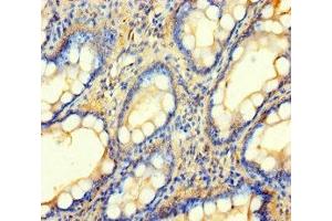 Immunohistochemistry of paraffin-embedded human small intestine tissue using ABIN7145543 at dilution of 1:100