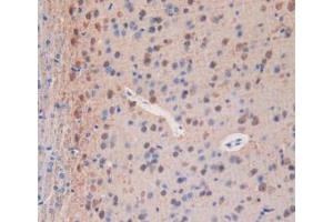 IHC-P analysis of Mouse Brain Tissue, with DAB staining. (PLA2R1 Antikörper  (AA 1418-1487))