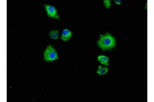 Immunofluorescence staining of Hela cells with ABIN7162449 at 1:100, counter-stained with DAPI. (P2RX7 Antikörper  (AA 110-247))