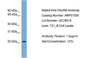 WB Suggested Anti-C9orf95  Antibody Titration: 0.