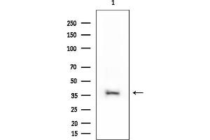 anti-Heterogeneous Nuclear Ribonucleoprotein A1-Like 2 (HNRNPA1L2) antibody