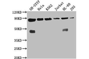 Western Blot Positive WB detected in: SH-SY5Y whole cell lysate, Hela whole cell lysate, K562 whole cell lysate, Jurkat whole cell lysate, HL60 whole cell lysate, 293 whole cell lysate All lanes: YY1AP1 antibody at 1:2000 Secondary Goat polyclonal to rabbit IgG at 1/50000 dilution Predicted band size: 88, 84, 82, 81, 76, 80, 51, 96, 98 kDa Observed band size: 88 kDa