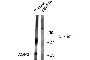 Western blots of rat kidney lysate showing specific immunolabeling of the ~ 29k and 37k glycosylated form of the AQP2 protein phosphorylated at Ser261.