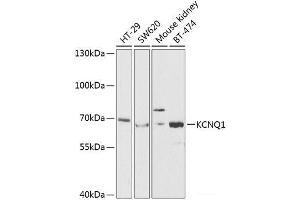 Western blot analysis of extracts of various cell lines using KCNQ1 Polyclonal Antibody at dilution of 1:1000. (KCNQ1 Antikörper)