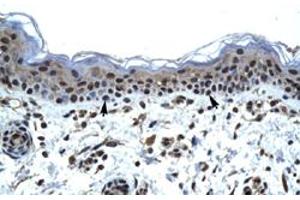 Immunohistochemical staining (Formalin-fixed paraffin-embedded sections) of human skin with IKZF5 polyclonal antibody  at 4-8 ug/mL working concentration. (IKZF5 Antikörper  (N-Term))