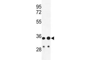 Western Blotting (WB) image for anti-Immunoglobulin Heavy Chain (IgH) (AA 290-320) antibody (ABIN3028730)