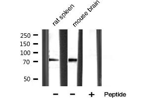 Western blot analysis of extracts of various sample,using MMP-9 Antibody. (MMP 9 Antikörper  (C-Term))