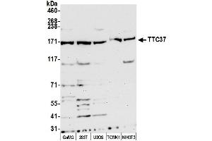 Western Blotting (WB) image for anti-Tetratricopeptide Repeat Domain 37 (TTC37) (AA 1-50) antibody (ABIN7452668)