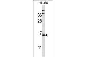 Western blot analysis in HL-60 cell line lysates (35ug/lane). (NDUFAF4 Antikörper  (N-Term))