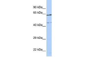 CCDC74A antibody used at 1 ug/ml to detect target protein. (CCDC74A Antikörper  (Middle Region))