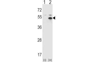 Western Blotting (WB) image for anti-Signal Transducing Adaptor Molecule (SH3 Domain and ITAM Motif) 1 (STAM) antibody (ABIN3001495) (STAM Antikörper)