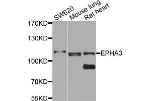 Western blot analysis of extracts of various cells, using EPHA3 antibody. (EPH Receptor A3 Antikörper)