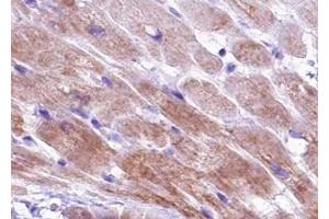 ABIN6267426 at 1/100 staining human Heart muscle tissue sections by IHC-P.