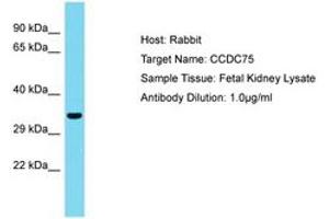 Image no. 1 for anti-Coiled-Coil Domain Containing 75 (CCDC75) (AA 36-85) antibody (ABIN6750780) (CCDC75 Antikörper  (AA 36-85))