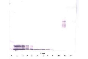 Image no. 4 for anti-Platelet Factor 4 (PF4) antibody (ABIN465152) (PF4 Antikörper)