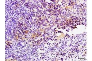 Formalin-fixed and paraffin embedded mouse colon carcinoma labeled with Anti-GPR49/LGR5 Polyclonal Antibody, Unconjugated  at 1:200 followed by conjugation to the secondary antibody and DAB staining. (LGR5 Antikörper  (AA 810-907))
