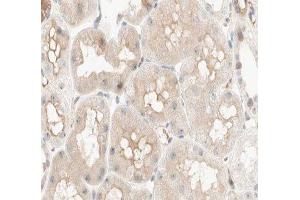 ABIN6277033 at 1/100 staining human kidney tissue sections by IHC-P. (PCK1 Antikörper  (C-Term))
