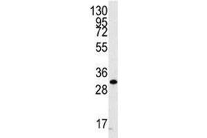 Western blot analysis of CDC2 antibody and A2058 cell lysate. (CDK1 Antikörper  (AA 213-241))