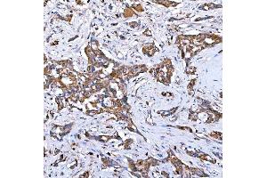 IHC analysis of RAB7/RAB7A using anti-RAB7/RAB7A antibody (ABIN7600597).