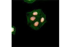 Immunofluorescence (IF) image for anti-H2A Histone Family, Member X (H2AFX) (pSer139) antibody (ABIN2666075)