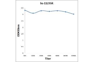 Antigen: 2 µg/100 µL Primary: Antiserum, 1:500, 1:1000, 1:2000, 1:4000, 1:8000, 1:16000, 1:32000; Secondary: HRP conjugated Rabbit Anti-Goat IgG at 1: 5000; TMB staining Read the data in Microplate Reader by 450nm. (GRK4/GRK5/GRK6 (AA 181-280) Antikörper)