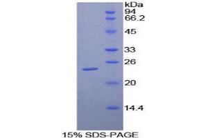 SDS-PAGE (SDS) image for Leukocyte Immunoglobulin-Like Receptor B3 (LILRB3) (AA 217-407) protein (His tag) (ABIN1879168)