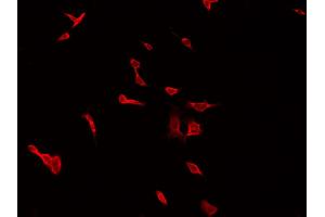 ABIN6266623 staining HepG2 by IF/ICC. (Peripherin Antikörper  (C-Term))