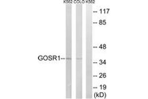 Western blot analysis of extracts from COLO/K562 cells, using GOSR1 Antibody. (GS28 Antikörper  (AA 11-60))