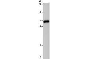 Gel: 8 % SDS-PAGE, Lysate: 40 μg, Lane: Human kidney tissue, Primary antibody: ABIN7191664(NMT1 Antibody) at dilution 1/200, Secondary antibody: Goat anti rabbit IgG at 1/8000 dilution, Exposure time: 3 minutes (NMT1 Antikörper)
