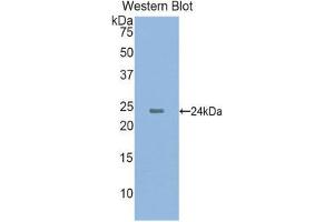 Western Blotting (WB) image for anti-Cathelicidin Antimicrobial Peptide (CAMP) (AA 31-170) antibody (Biotin) (ABIN1175686) (Cathelicidin Antikörper  (AA 31-170) (Biotin))