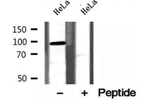 Western blot analysis of extracts of HeLa cells, using PYGL antibody. (PYGL Antikörper  (Internal Region))