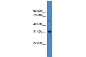 Image no. 1 for anti-Ladybird Homeobox 1 (Lbx1) (AA 21-70) antibody (ABIN6745343)
