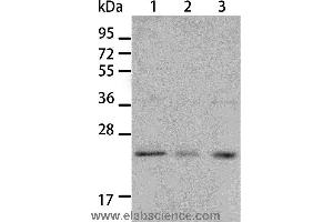Western blot analysis of A431 and A172 cell, human liver cancer tissue, using BNIP1 Polyclonal Antibody at dilution of 1:550 (BNIP1 Antikörper)