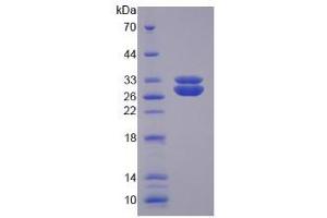 SDS-PAGE analysis of Human SOD3 Protein. (SOD3 Protein)