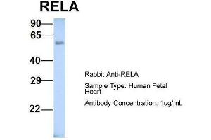 Host: Rabbit  Target Name: RELA  Sample Tissue: Human Fetal Heart  Antibody Dilution: 1. (NF-kB p65 Antikörper  (Middle Region))