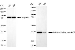 Western blotting analysis using calcium binding protein 39 antibody (ABIN7797828). (Rekombinanter CAB39 Antikörper)