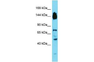 Host: Rabbit Target Name: SYDE2 Sample Type: Fetal Liver lysates Antibody Dilution: 1.