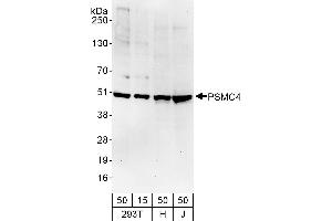 Western Blotting (WB) image for anti-Proteasome (Prosome, Macropain) 26S Subunit, ATPase, 4 (PSMC4) (AA 368-418) antibody (ABIN7454974)