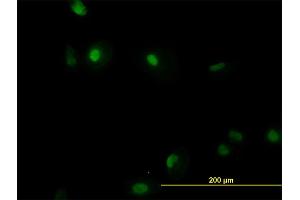 Immunofluorescence of monoclonal antibody to RUNX1 on HeLa cell. (RUNX1 Antikörper  (AA 210-310))