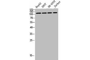 Western blot analysis of SW480 MCF7 lysate, antibody was diluted at 500. (DAAM1 Antikörper  (AA 400-500))