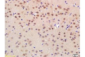 Formalin-fixed and paraffin embedded rat brain labeled with Rabbit Anti NRF-1 Polyclonal Antibody, Unconjugated (ABIN675219) at 1:200 followed by conjugation to the secondary antibody and DAB staining