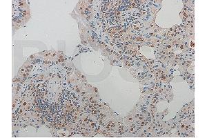 Formalin-fixed and paraffin-embedded rat aortic tissue labeled with Rabbit Anti-NFKB p65 Polyclonal Antibody (ABIN668961), Unconjugated at 1:600 followed by conjugation to the secondary antibody and DAB staining (NF-kB p65 Antikörper  (AA 51-100))