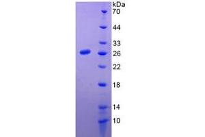 SDS-PAGE of Protein Standard from the Kit (Highly purified E. (Prolactin CLIA Kit)