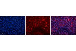 Immunohistochemistry (IHC) image for anti-Interleukin enhancer-binding factor 3 (ILF3) (N-Term) antibody (ABIN2780867)